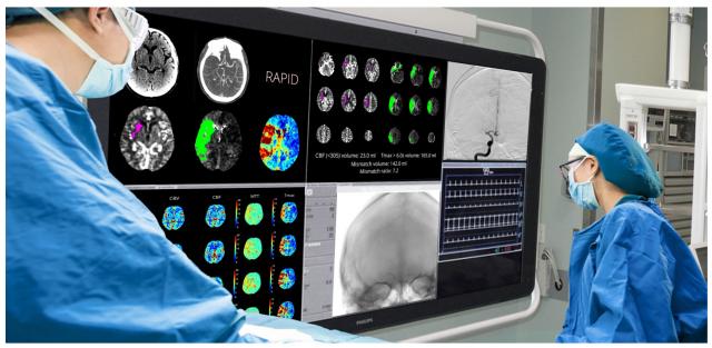 ［キニナルッ］脳梗塞の急性期治療の向上に向け脳画像解析プログラムを四国初導入